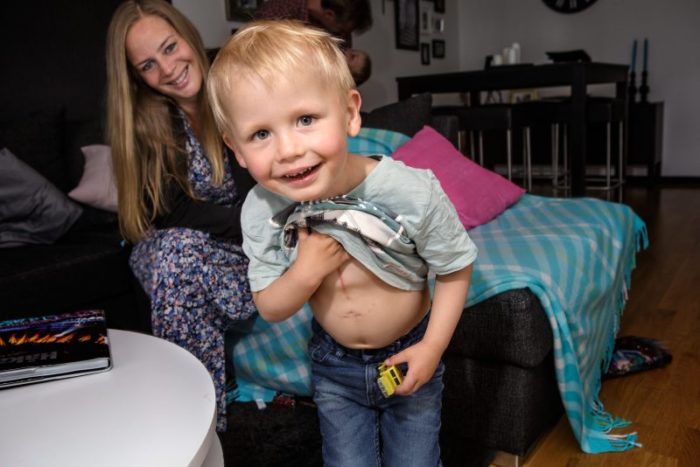 Otis visar sitt ärr