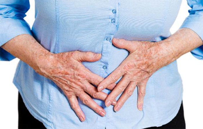 IBD FODMAp